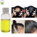 High quality Ginger Oil Anti Hair Loss